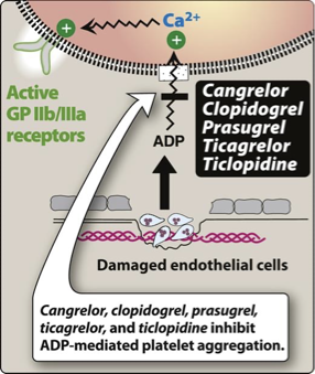<p><strong>MOA</strong>: Irreversible inhibition of ADP pathway of platelets; <strong>blocks the ADP receptor on platelets</strong>; </p><ul><li><p>no effect on prostaglandins</p></li></ul><ul><li><p><strong>inhibit binding of ADP to P2Y12 receptor on platelets</strong> → inhibit activation of GPIIb/IIIa receptors required for platelets to bind to fibrinogen and to each others</p></li></ul><p></p>