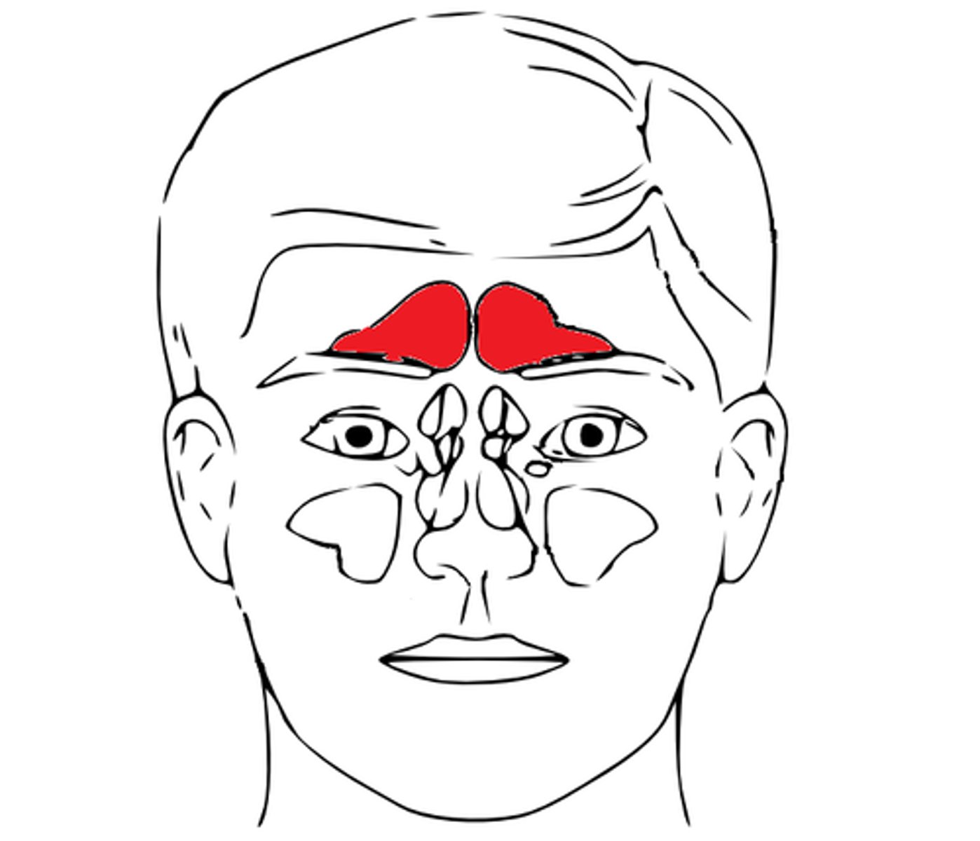 <p>Sinus frontalis</p>