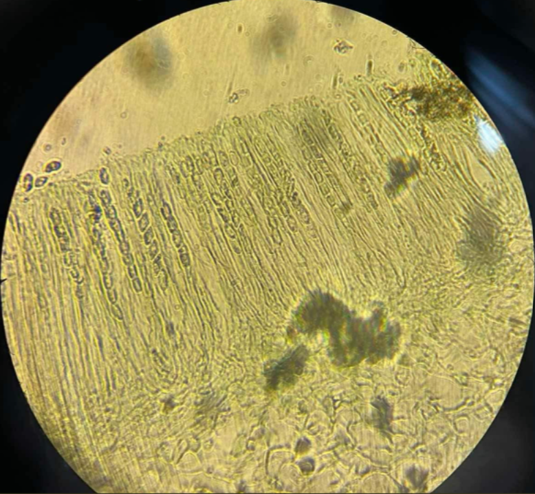 <p>Ascomycota; a large genus of saprophytic cup fungi that grow on the ground, rotting wood, or dung</p>