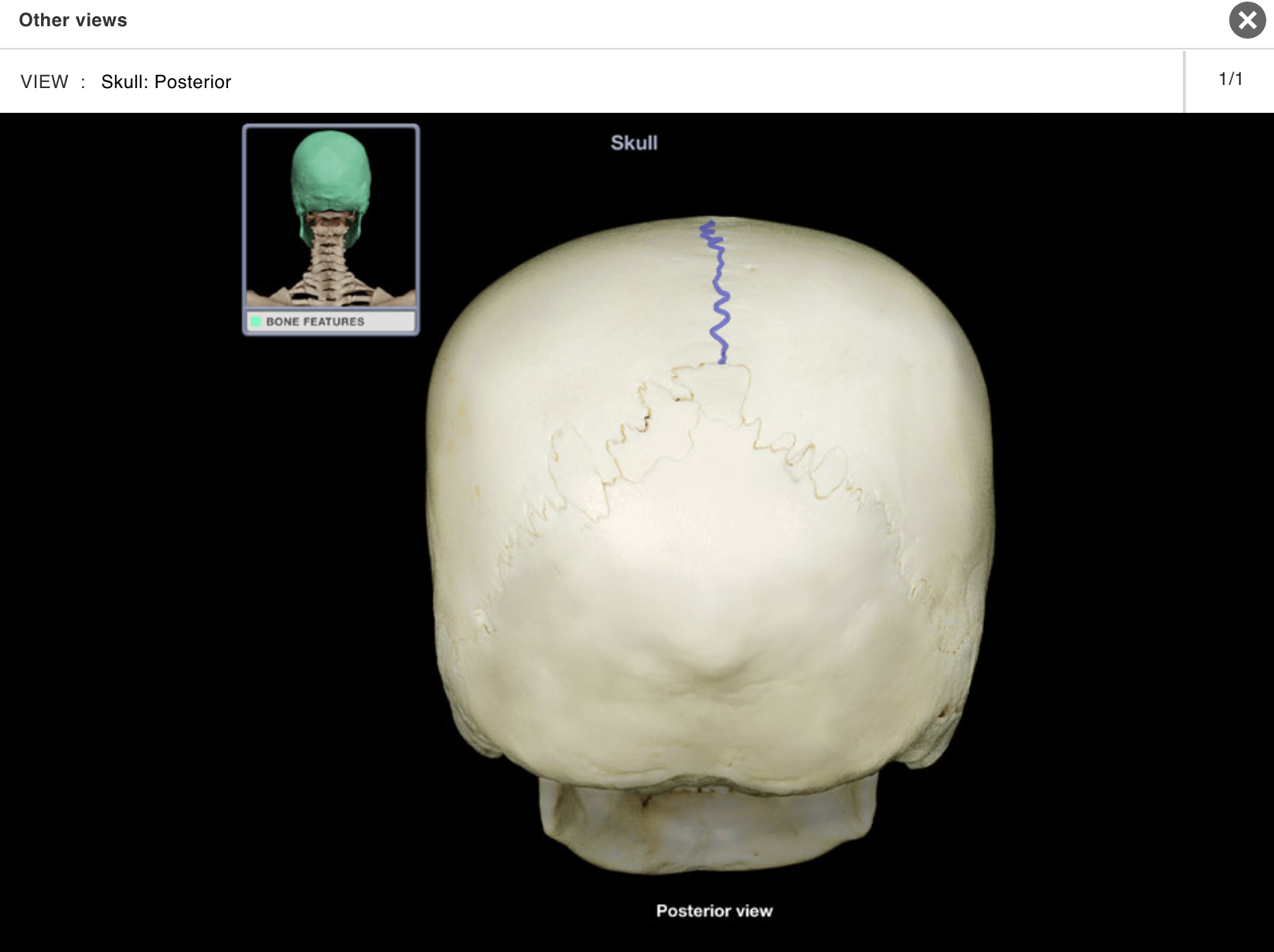 <p>Location:</p><p class="p1">• Skull (superior)</p><p class="p1">Description:</p><p class="p1">• Joint between parietal bones</p>