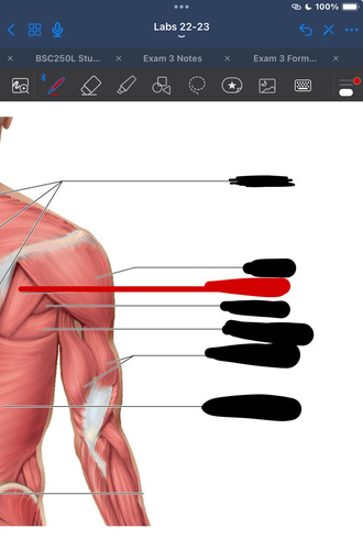 <p>What muscle is this?</p>