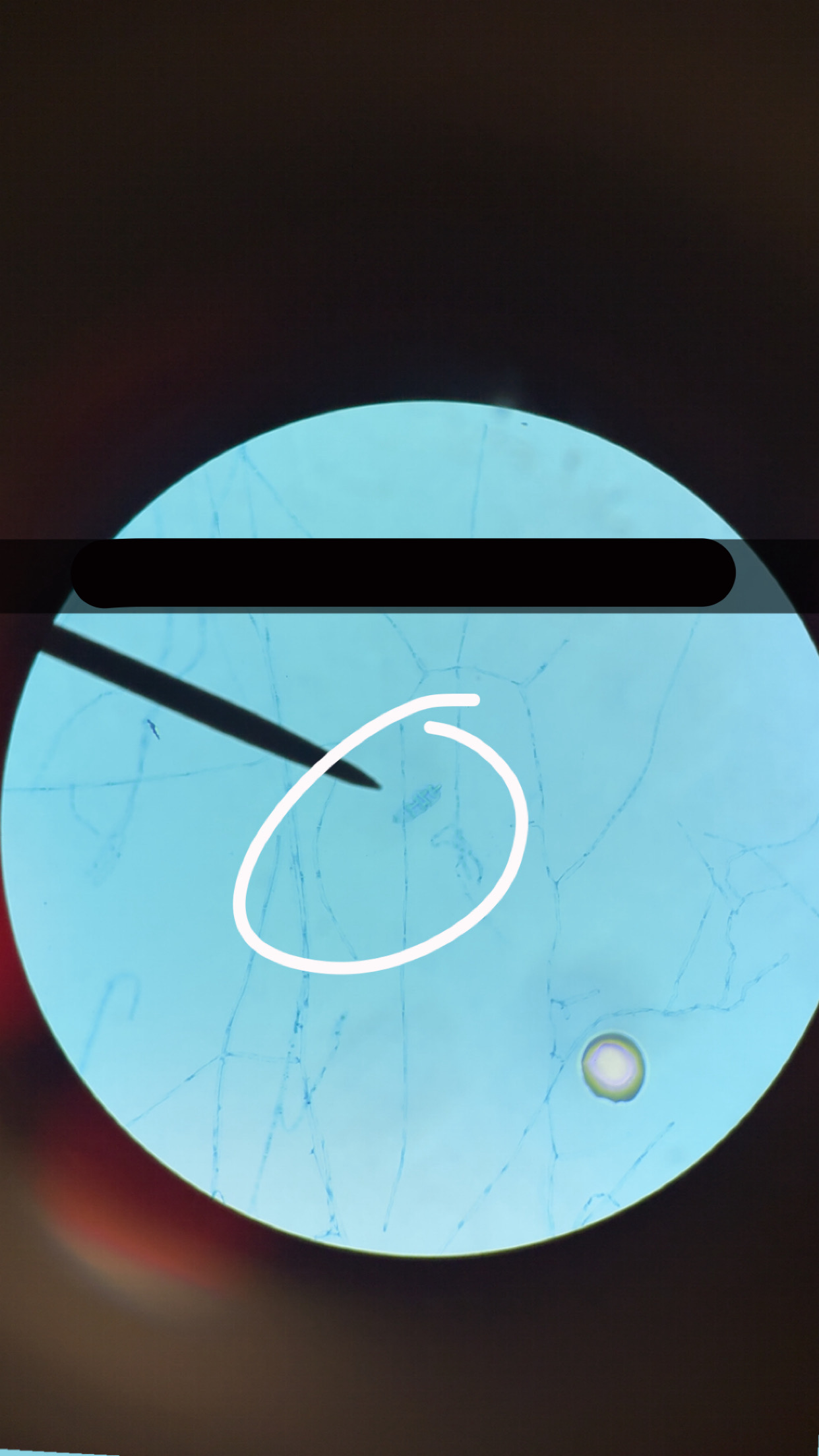<p>What’s the name of this </p>
