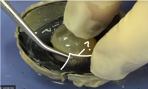 <p>What are the suspensory ligaments attached to?</p>