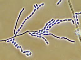 <p>YEAST-LIKE</p><p></p>