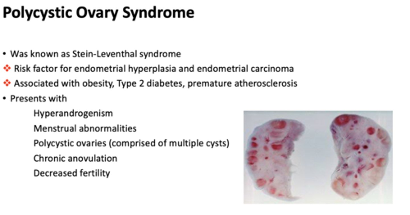 <p>polycystic ovary syndrome</p>
