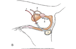 <p>horizontally oriented between the hindlimbs</p>