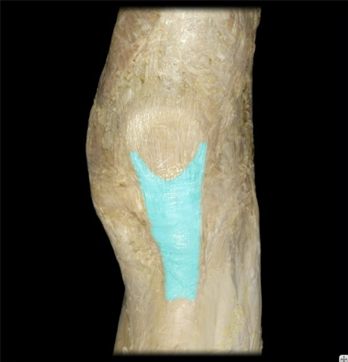 term image