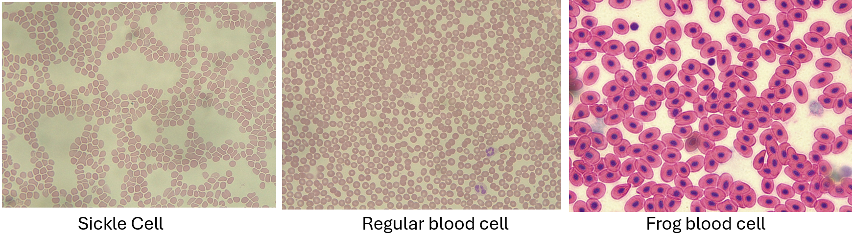 <p>Normal: round, plump looking<br>Sickle: concaved, get easily stuck on other things<br>Frog blood: nucleated</p>