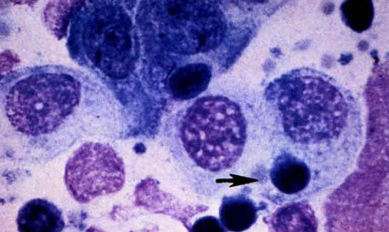 term image
