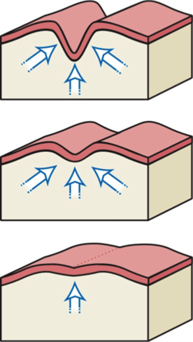 <p>Two types:<br>1. fusion of swellings/tissue on the SAME surface<br>2. fusion of swellings/tissue from DIFFERENT surfaces (occurs for upper lip and palate)<br><br>The clefts/furrows between the swellings are eliminated as the <b>underlying mesenchyme migrates</b> into the furrow, making the facial surface smooth. Migration occurs when mesenchyme grows and merges beneath the external ectoderm during maturation of the structure.</p>