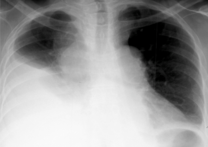 <p>What is this patient presenting with?</p>