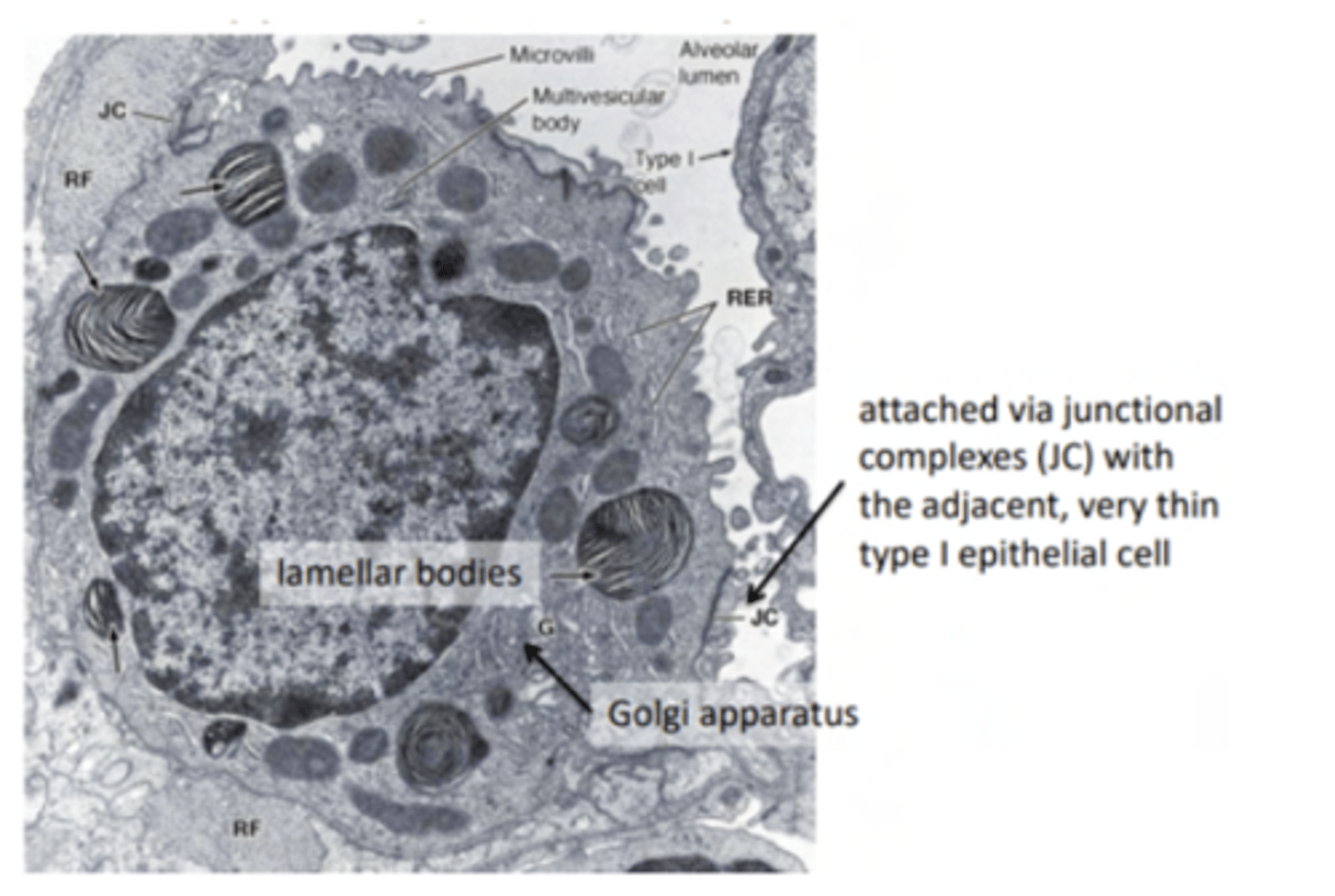 <p>secrete surfactant (mix of protein and lipids). They are analogue to Clara cells</p>