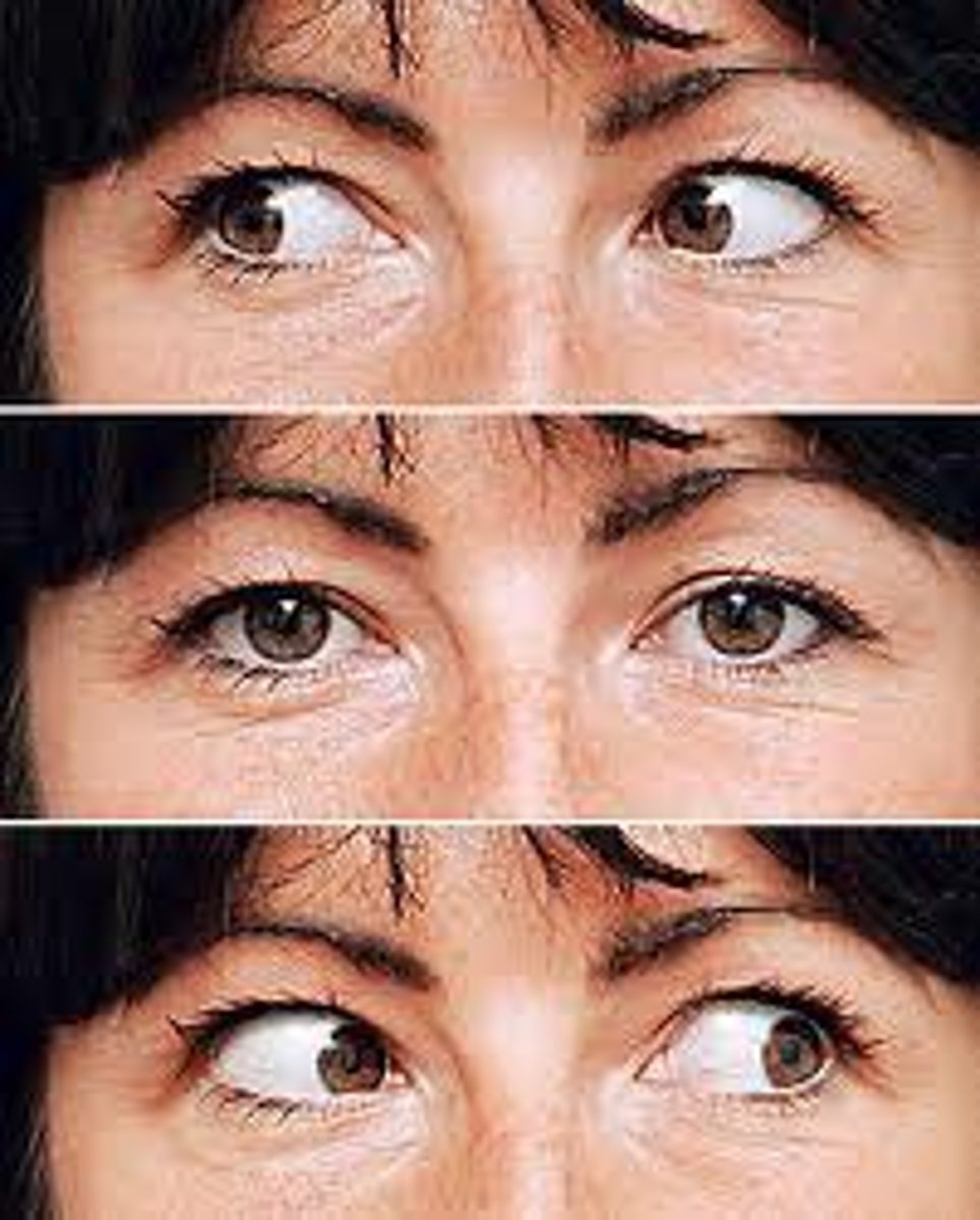 <p>A type of eye movement, made both voluntarily and involuntarily, in which the eyes rapidly change fixation from one object or location to another.</p>