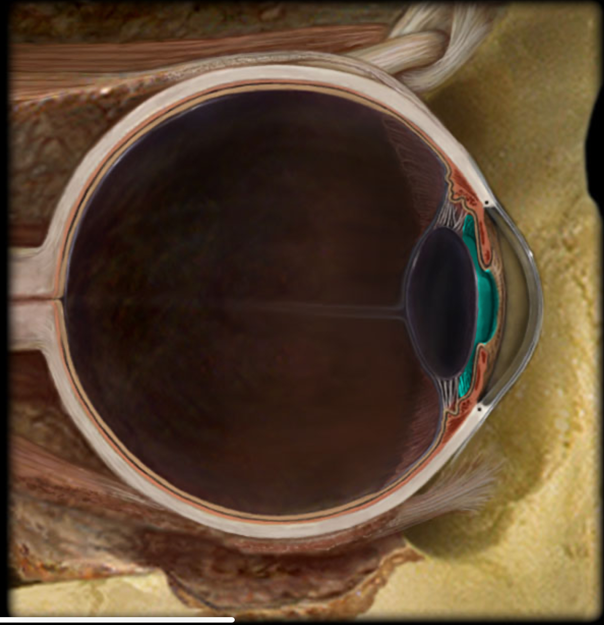 <h4 collapsed="false" seolevelmigrated="true"><strong>Location:</strong></h4><ul><li><p>Anterior cavity of eye</p></li><li><p>Between iris, ciliary body, and lens</p></li></ul><h4 collapsed="false" seolevelmigrated="true"><strong>Description:</strong></h4><ul><li><p>Subdivision of anterior cavity</p></li><li><p>Filled with aqueous humor</p></li></ul><h4 collapsed="false" seolevelmigrated="true"><strong>Comment:</strong></h4><ul><li><p>Aqueous humor produced in posterior chamber; passes through pupil; enters anterior chamber; reabsorbed into venous system through scleral venous sinus (canal of Schlemm)</p></li></ul>