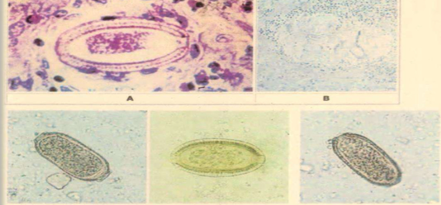 <p>Parasite under microscope?</p>