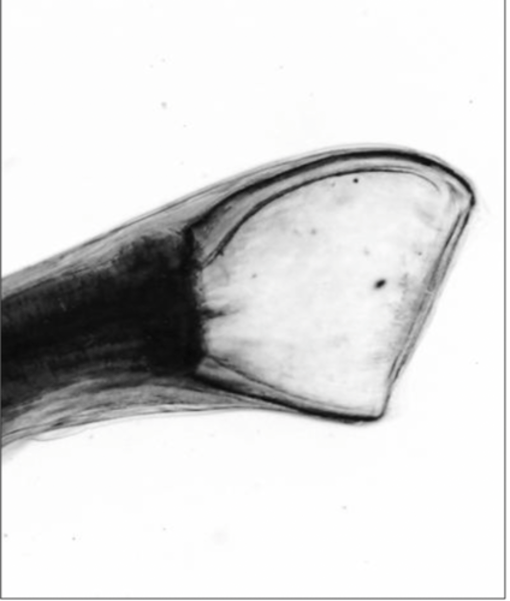 <p>What is this parasite? What characteristic/s did you use to identify it?</p>