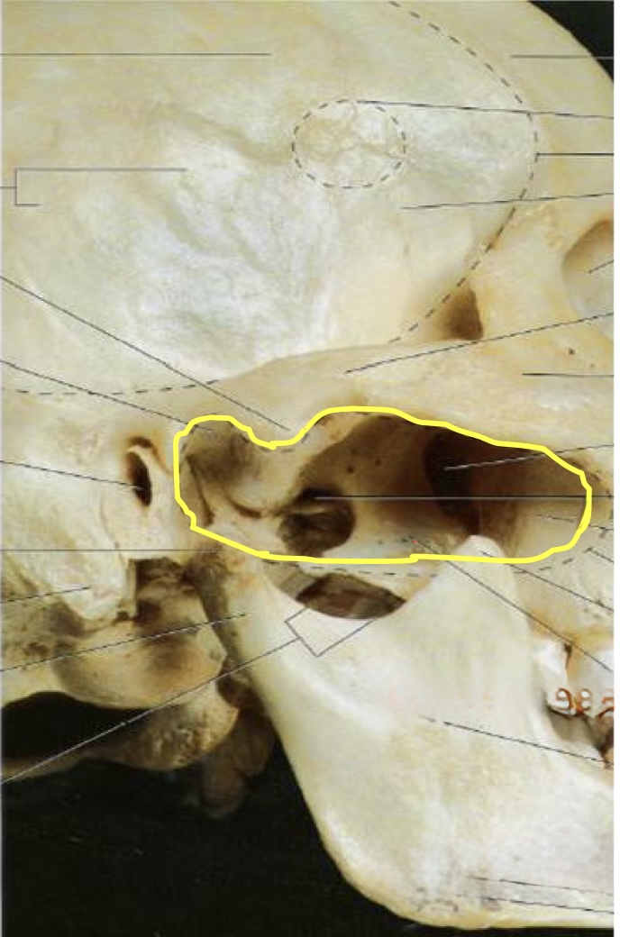 <p>what structure is circled in yellow?</p>