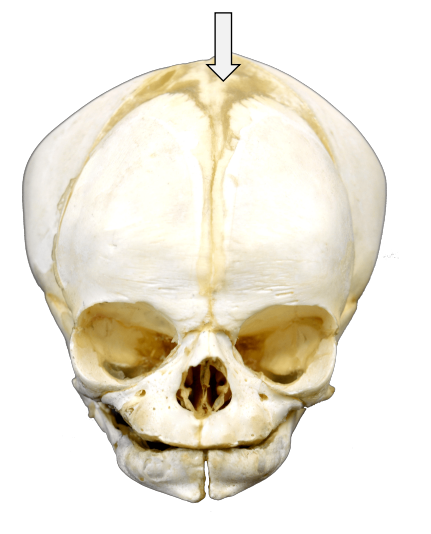 <p>Dense connective tissue regions between incompletely ossified cranial bones</p>