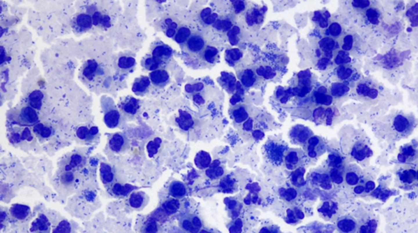 <p>What kind of inflammation is this?</p>