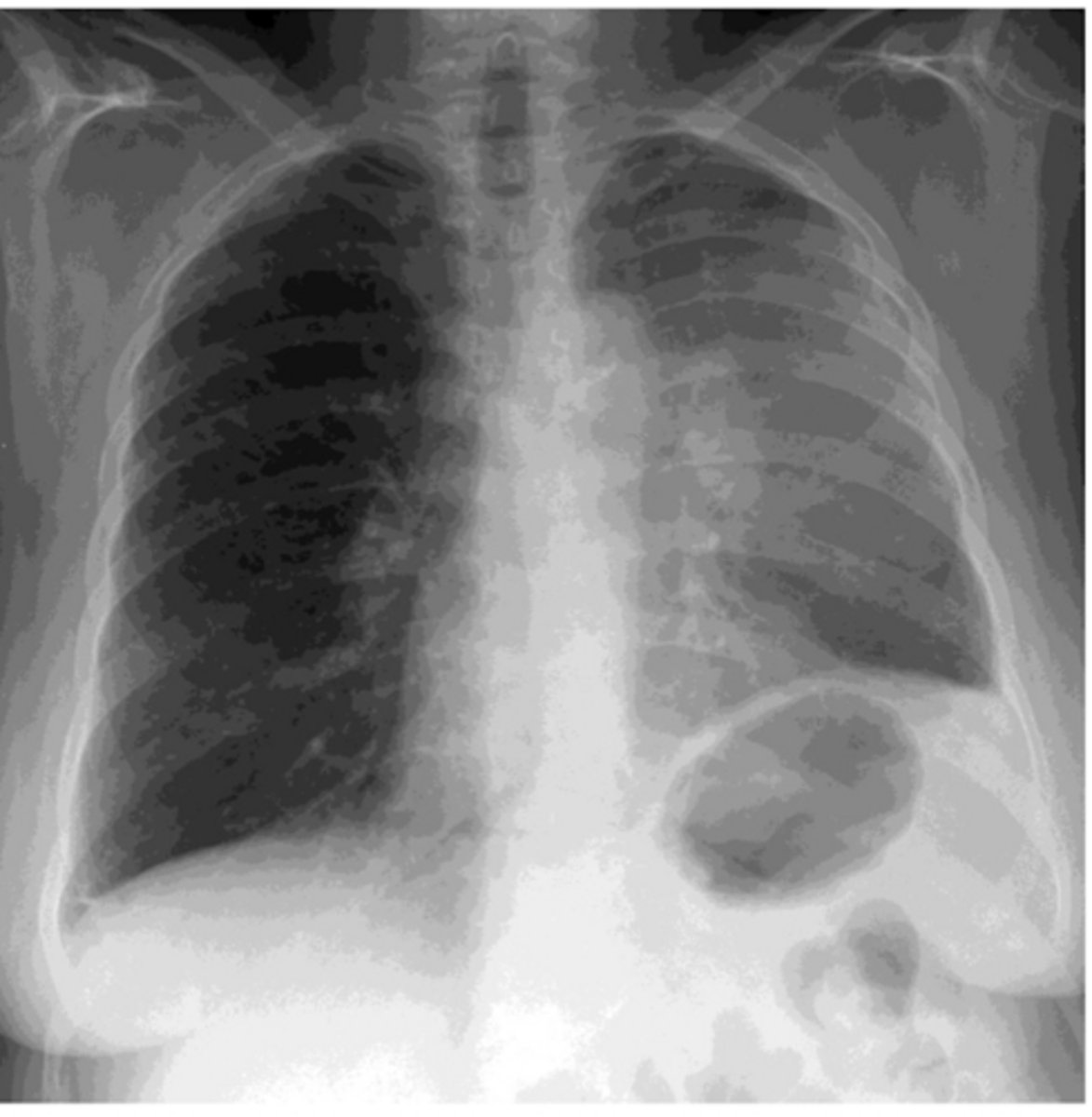 <p>What is the diagnosis?</p>