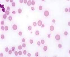 <p>This was found on a blood smear from a steer.</p>