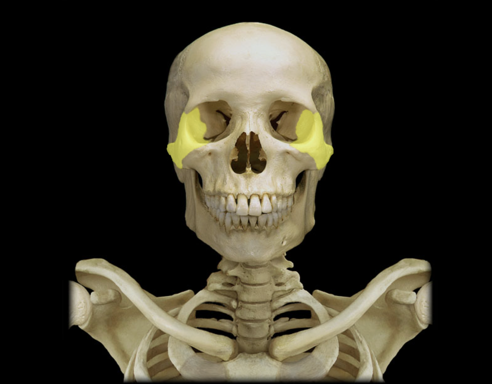 <p>Zygomatic bone</p>