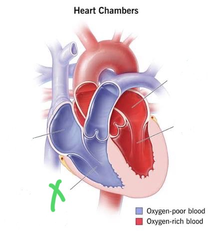 <p>Lower right chamber; pumps deoxygenated blood to lungs through pulmonary semilunar valve.</p>