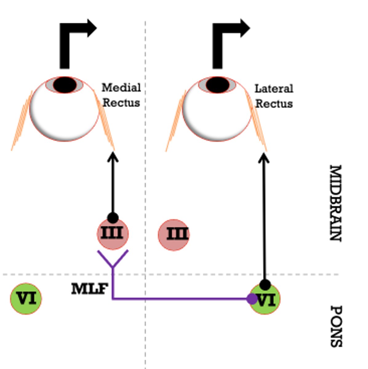 <p>can't clearly differentiate between midbrain and pons</p>