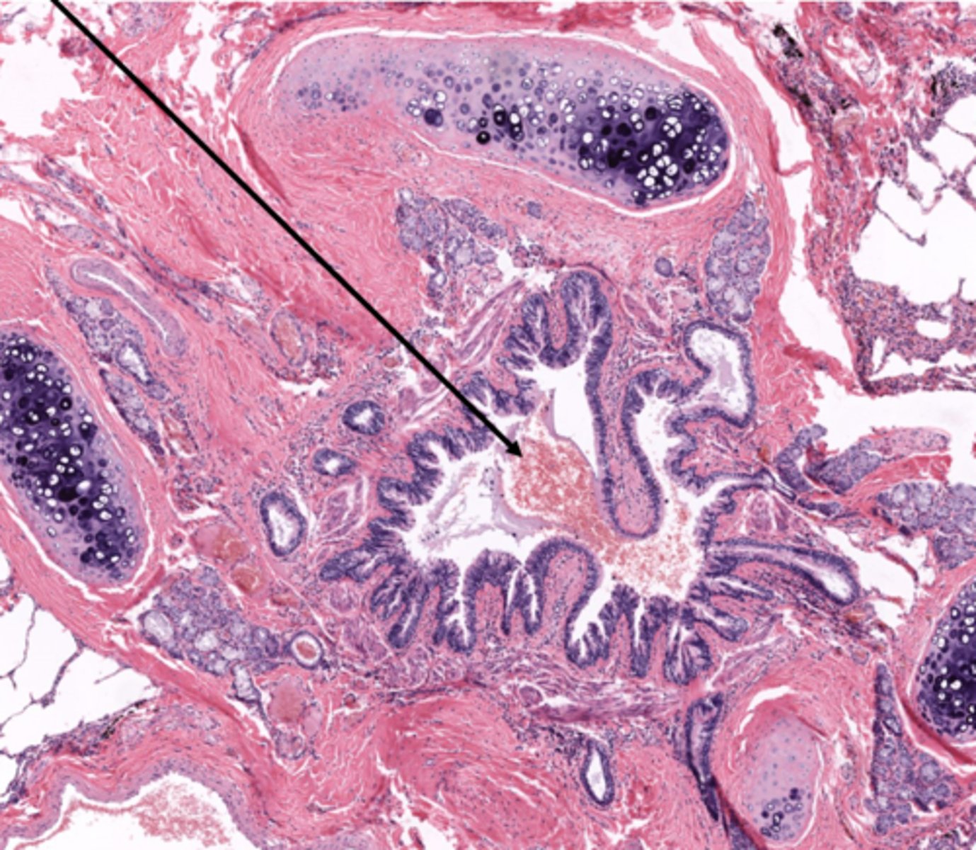 <p>Identify the type of airway</p>