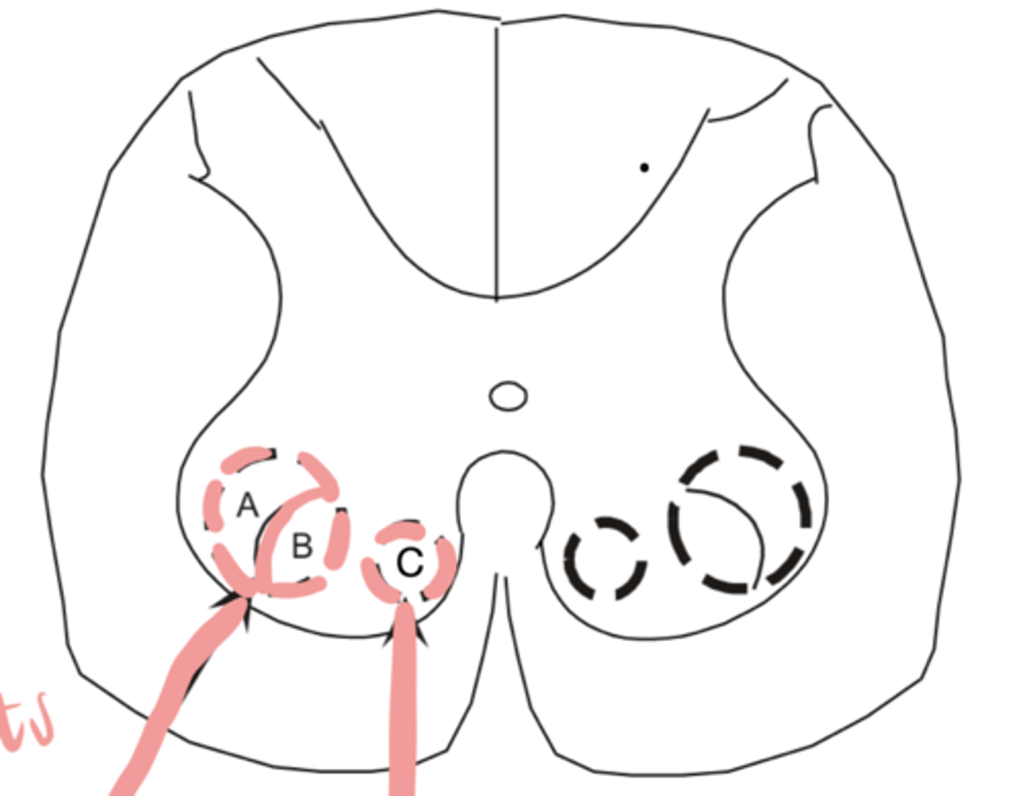 <p>An injury or damage to B would present as</p>