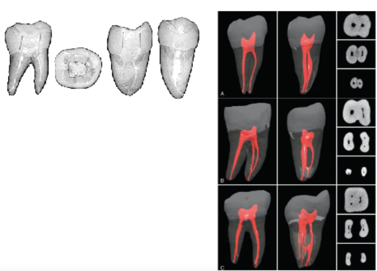 <p>mesial root larger than distal root</p>