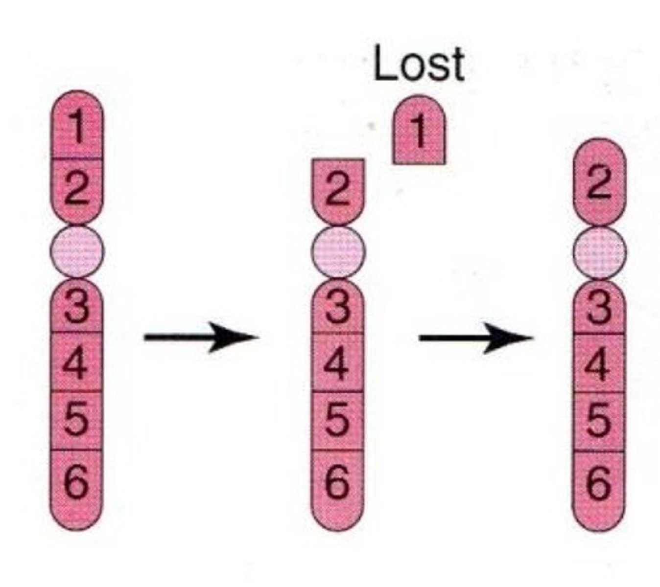 <p>Loss of a segment from the end of a linear chromosome.</p><p></p><p><em>Usually caused by a chromosome break</em></p>