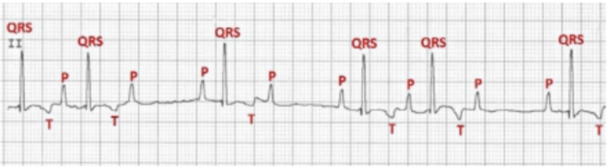 <p><span>Name, reading summary, and significance of this rhythm:</span></p>