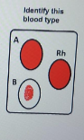 <p>What blood type is in the tray?</p>