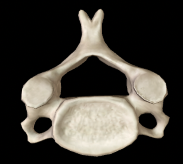 <p>Which section of the vertebral column does this bone belong to?</p>