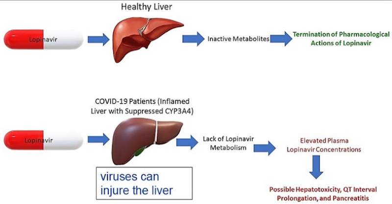 <p><span><span>Disorders are common and symptoms are diverse. They can affect drug metabolism.</span></span></p><ul><li><p><span><span>A damaged liver is less capable of metabolizing drugs, which leads to higher plasma drug levels and an increased risk of toxicity.</span></span></p></li><li><p><span><span>Injury also reduces the liver’s ability to handle other drugs and its normal biological functions</span></span></p></li><li><p><span><span>In patients with liver disease, drugs are metabolized more slowly → dosage must be reduced.</span></span></p></li></ul><p></p>