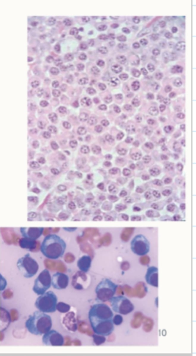 <p>What cell type are these</p>