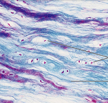 <p>what is the connective tissue?</p>