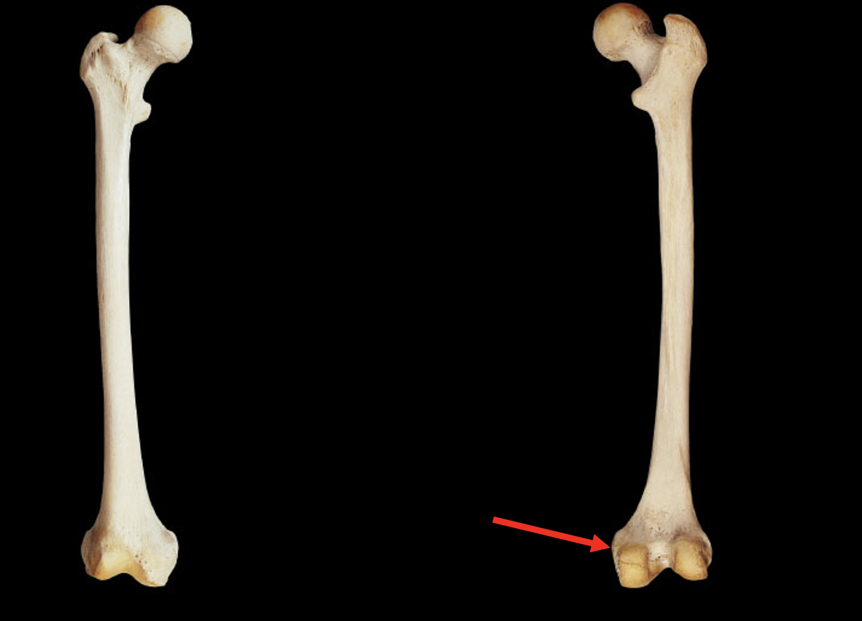 <p>Name this region of the femur</p>