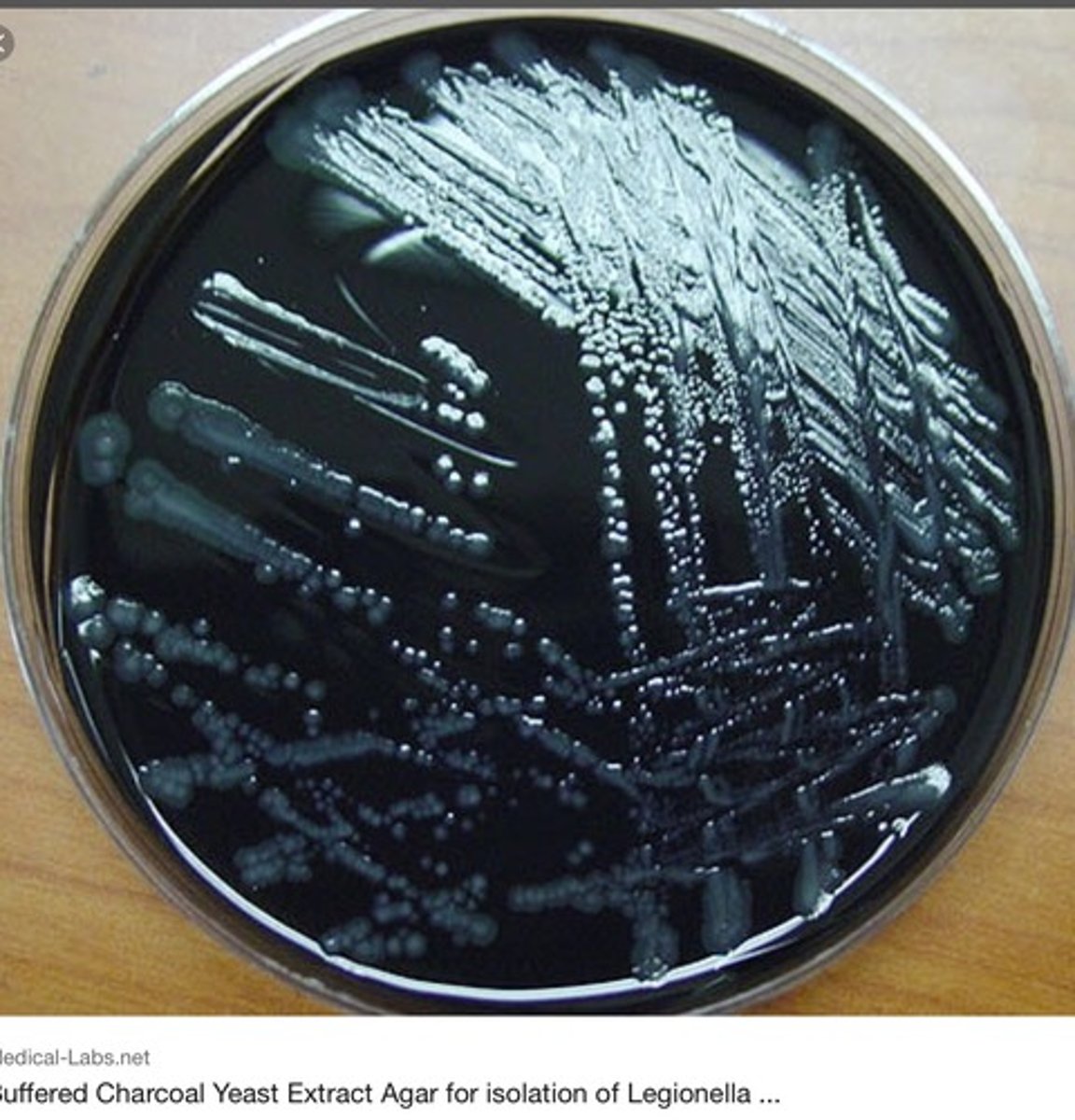 <p>Selective for the recovery of Legionella and Norcardia species.</p>