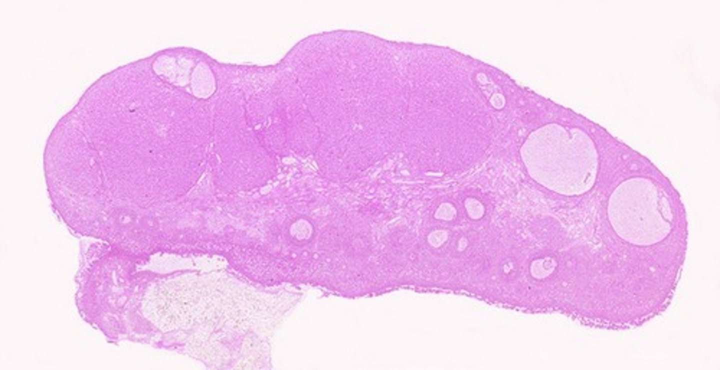 <p>Mature ovarian follicles containing a developing oocyte.</p>