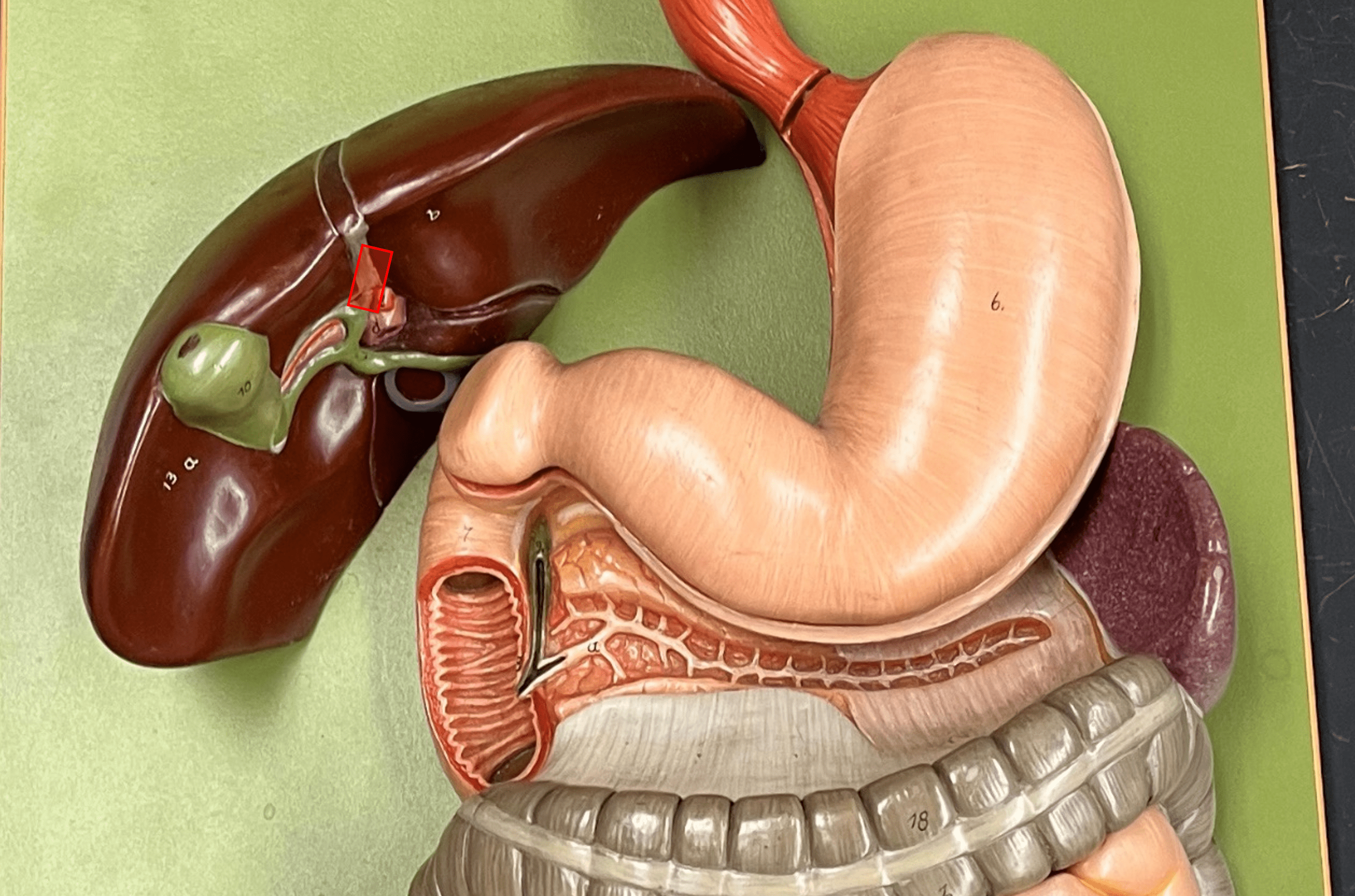 • A bile duct.

• The L. duct transports bile directly from the liver.

• Converges with the R. hepatic duct to form the common hepatic duct.