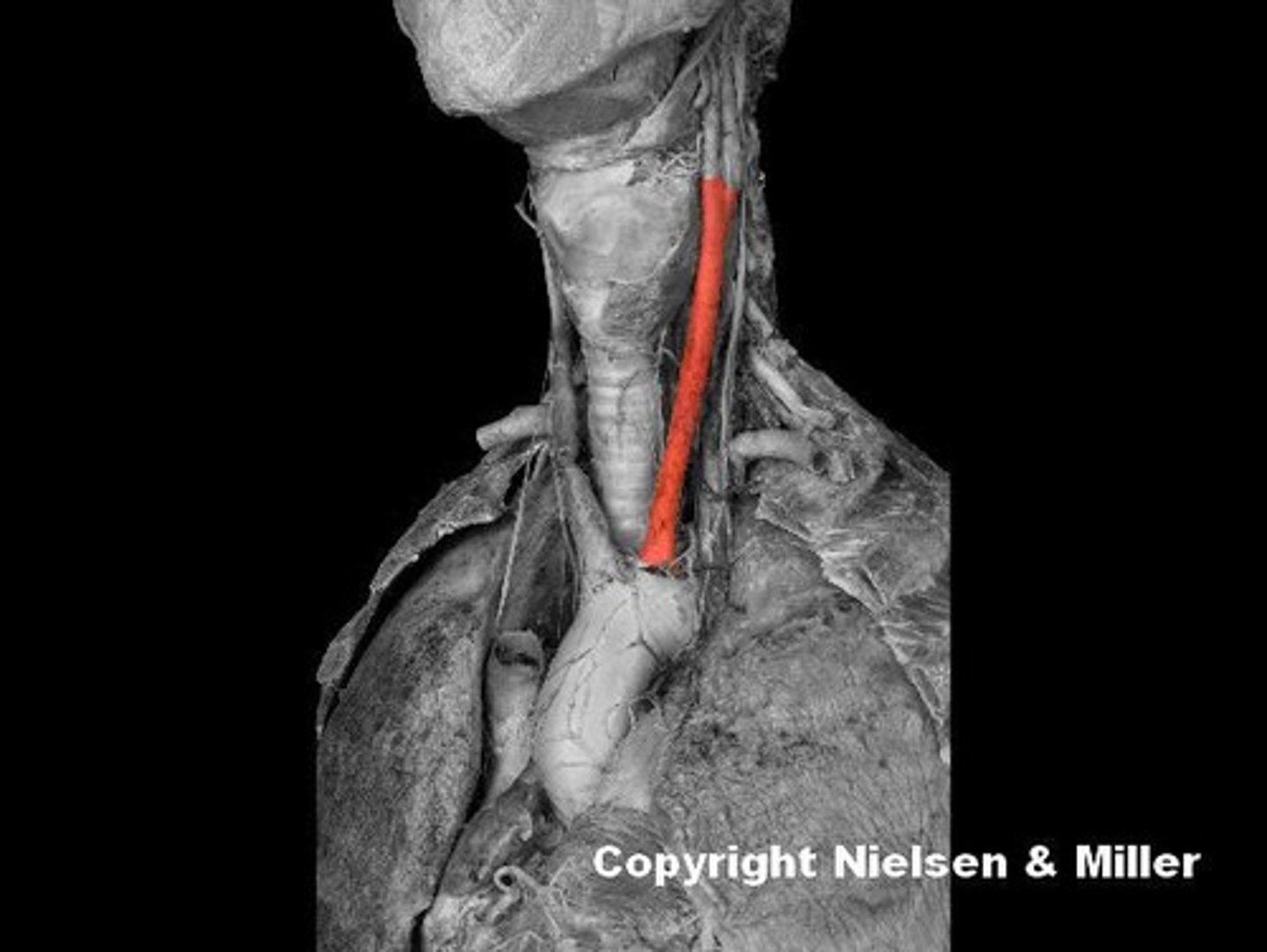 <p>Identify the highlighted vessel.</p>