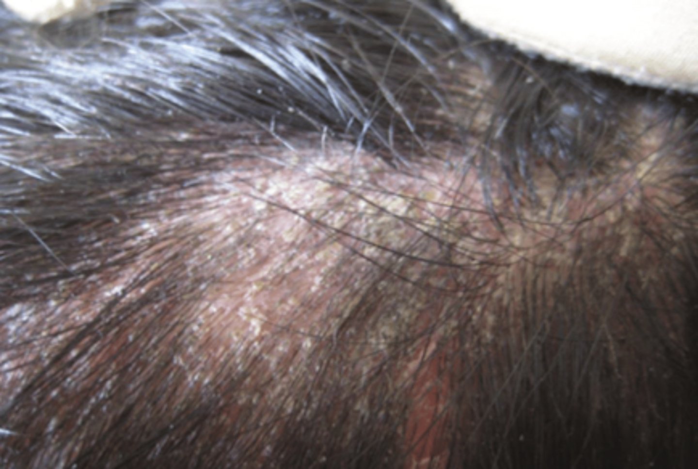 <p>What is the diagnosis?</p>