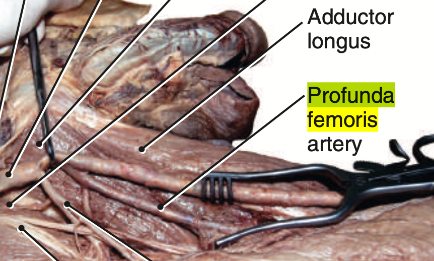 <p><strong>Within</strong> the Femoral Triangle. </p><p><strong>Postero- lateral aspect </strong>of the femoral artery</p>