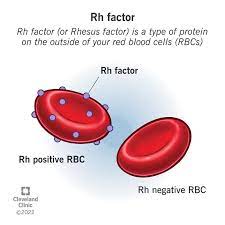 <p>A.K.A. D Antigen</p><ul><li><p>If the Rh antigen is present you are Rh positive (Rh+)</p></li><li><p>If the Rh antigen is absent you are Rh negative (Rh-)</p><ul><li><p>Only sensitized(exposed) Rh- blood has anti-Rh antibodies (only important when woman are pregnant, Rh- can cross the placenta)</p></li></ul></li></ul>