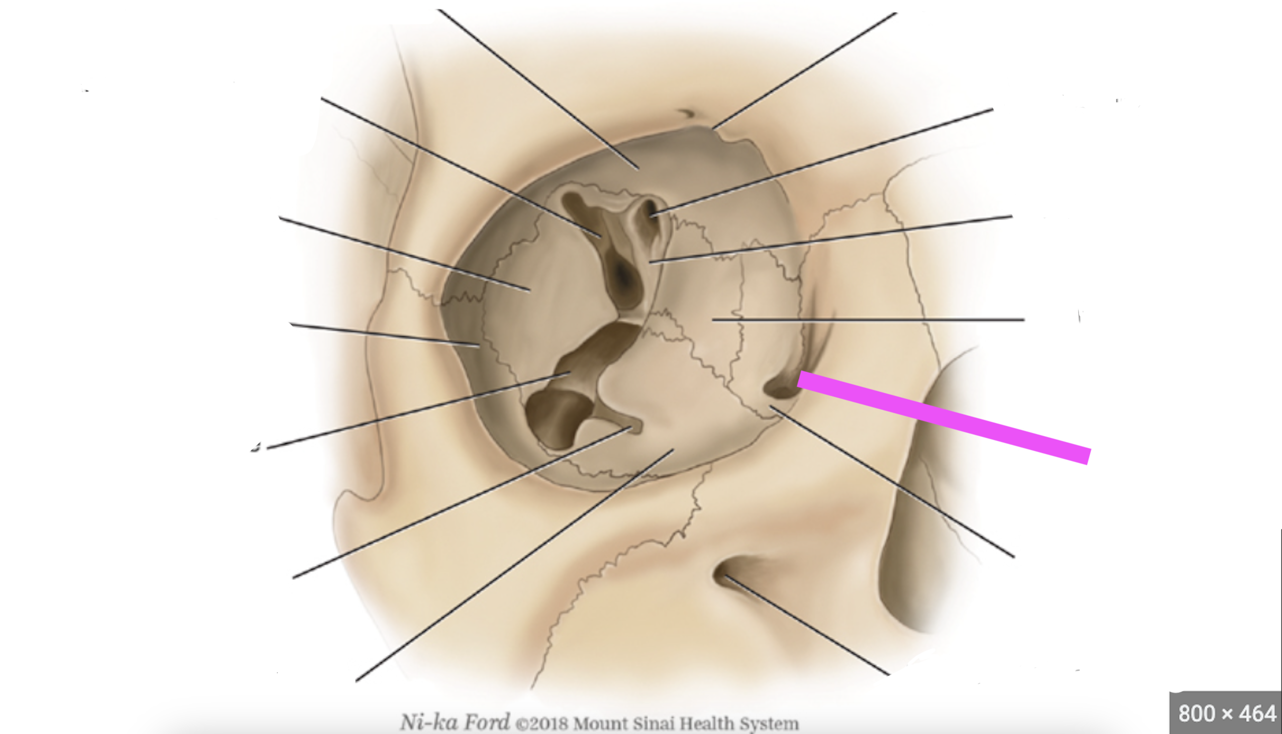 <p>What bone marking is this? <em>pink line</em>*</p>