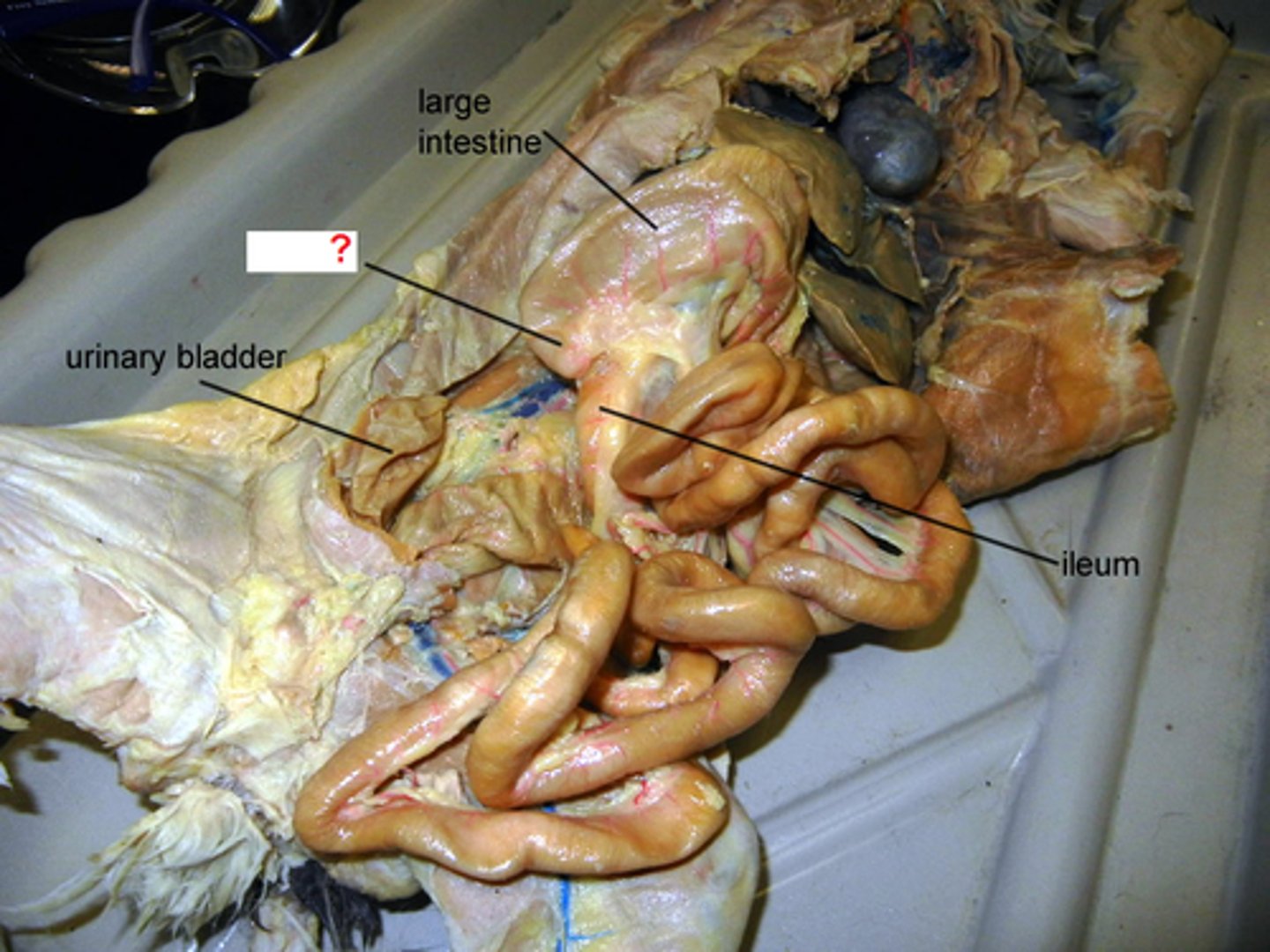 <p>first part of the large intestine</p>