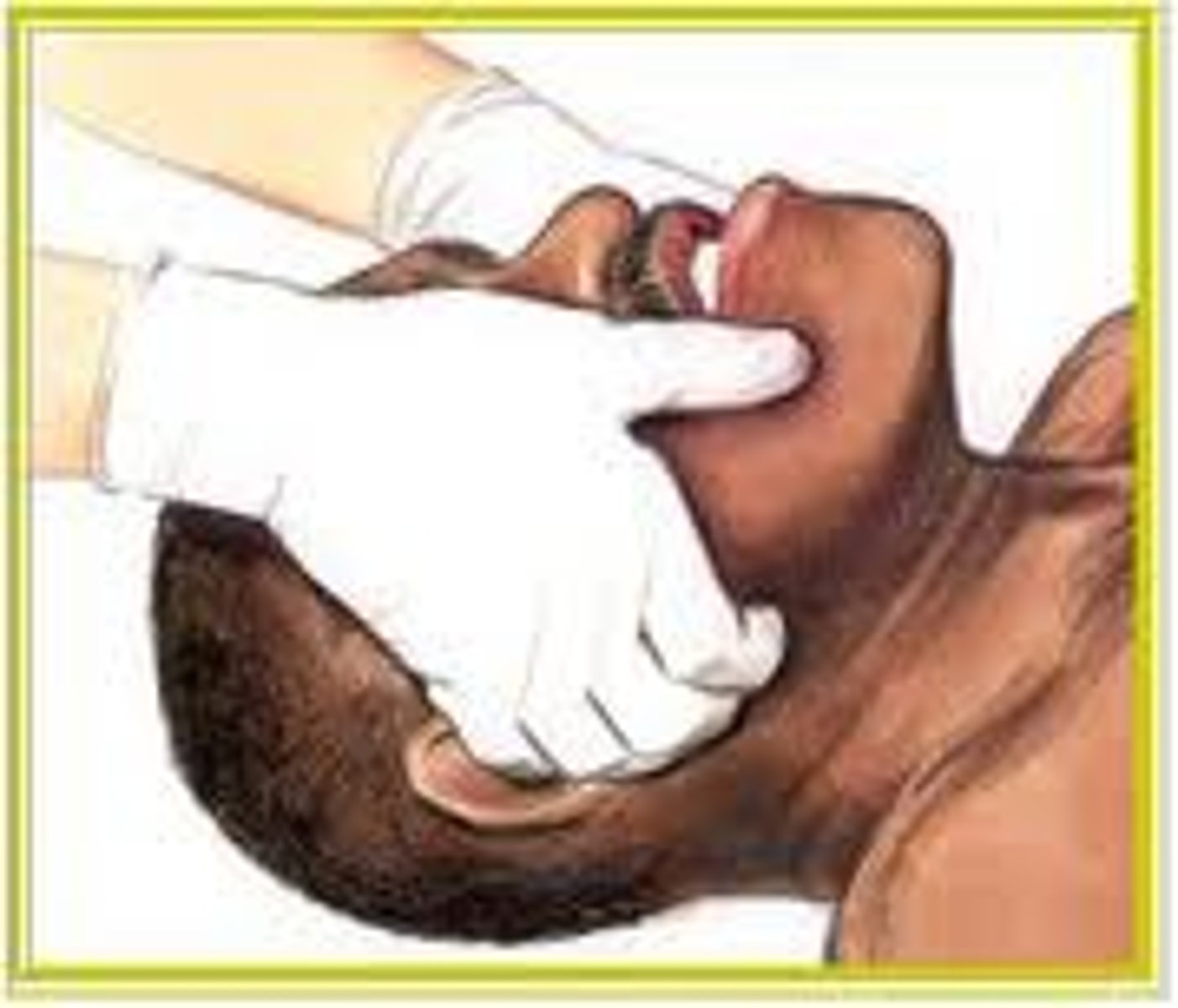 <p>A technique used to open the airway of a trauma patient with possible neck or spine injury</p>
