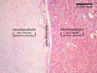 <p>front lobe of the pituitary gland, located at the base of the brain in the hypothalamus that produces GH, TSH, ACTH, FSH, LH and prolactin; activity is controlled by the releasing and inhibiting hormones from the hypothalamus; purely endocrine gland</p>